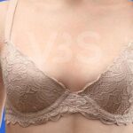 Breast Augmentation Before & After Patient #202