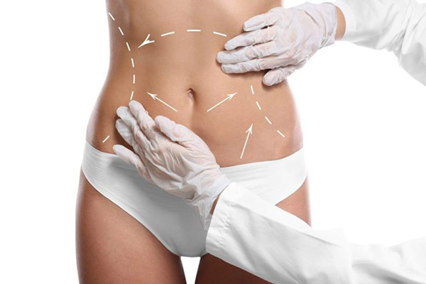 Vaser Liposuction Las Vegas