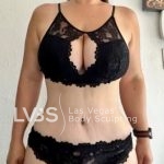 Tummy Tuck Before & After Patient #1129
